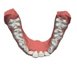 lowerJawModel